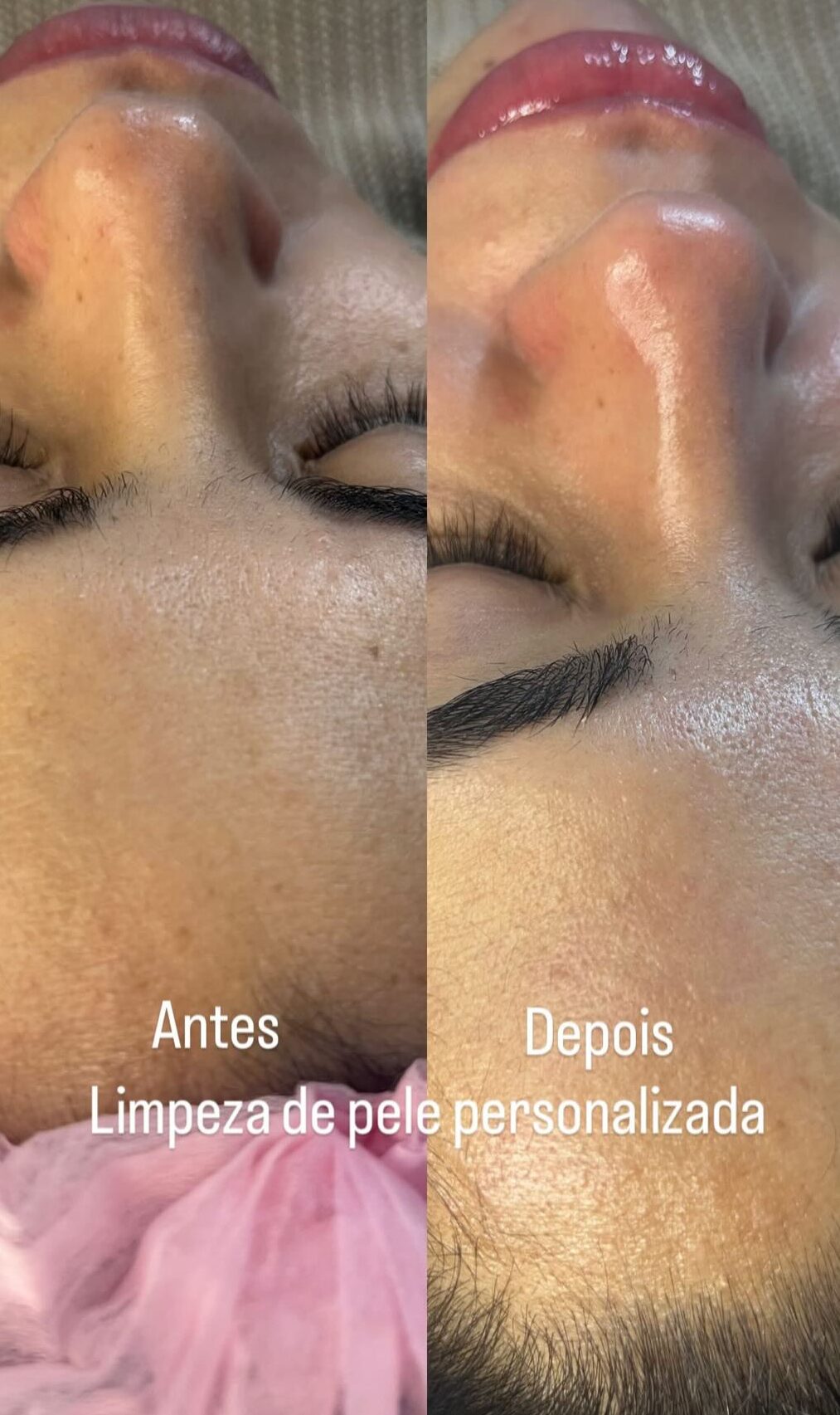 Estética Facial no Tatuapé – Salão Rosa Morena Estética Facial no Tatuapé – Salão Rosa Morena